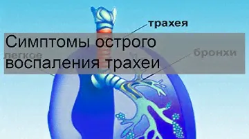 Симптомы острого воспаления трахеи