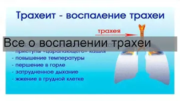 Все о воспалении трахеи
